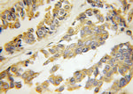 HARS2 Antibody in Immunohistochemistry (Paraffin) (IHC (P))