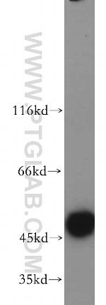 HARS2 Antibody in Western Blot (WB)