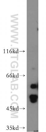 HARS2 Antibody in Western Blot (WB)