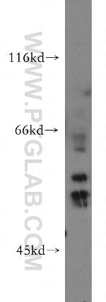 HARS2 Antibody in Western Blot (WB)