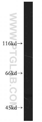 HARS2 Antibody in Western Blot (WB)