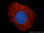 ribosomal protein L4 Antibody in Immunocytochemistry (ICC/IF)