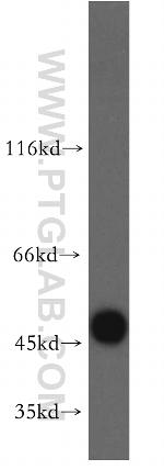 ribosomal protein L4 Antibody in Western Blot (WB)