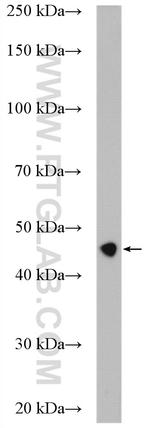 ribosomal protein L4 Antibody in Western Blot (WB)