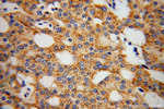 Rab18 Antibody in Immunohistochemistry (Paraffin) (IHC (P))