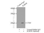 Rab18 Antibody in Immunoprecipitation (IP)