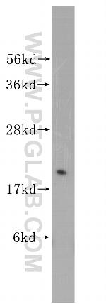 Rab18 Antibody in Western Blot (WB)