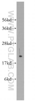 Rab18 Antibody in Western Blot (WB)