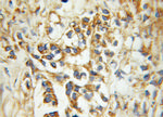 ECHS1 Antibody in Immunohistochemistry (Paraffin) (IHC (P))