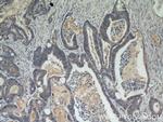 Beclin 1 Antibody in Immunohistochemistry (Paraffin) (IHC (P))