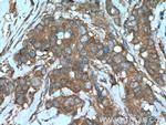 Beclin 1 Antibody in Immunohistochemistry (Paraffin) (IHC (P))