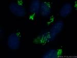 GOLGA2/GM130 Antibody in Immunocytochemistry (ICC/IF)