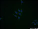 EIF5A Antibody in Immunocytochemistry (ICC/IF)