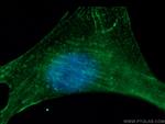 alpha Actinin Antibody in Immunocytochemistry (ICC/IF)