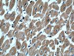 alpha Actinin Antibody in Immunohistochemistry (Paraffin) (IHC (P))