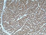 alpha Actinin Antibody in Immunohistochemistry (Paraffin) (IHC (P))