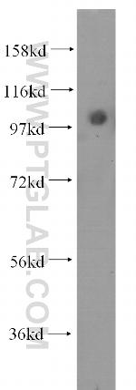 alpha Actinin Antibody in Western Blot (WB)