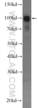 alpha Actinin Antibody in Western Blot (WB)