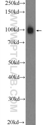 alpha Actinin Antibody in Western Blot (WB)