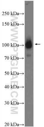 alpha Actinin Antibody in Western Blot (WB)