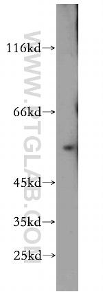 EYA2 Antibody in Western Blot (WB)