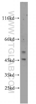 EYA2 Antibody in Western Blot (WB)