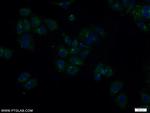 TOLLIP Antibody in Immunocytochemistry (ICC/IF)