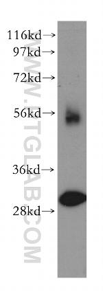 TOLLIP Antibody in Western Blot (WB)