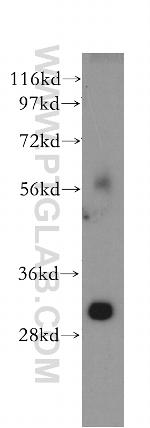 TOLLIP Antibody in Western Blot (WB)