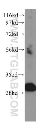 TOLLIP Antibody in Western Blot (WB)