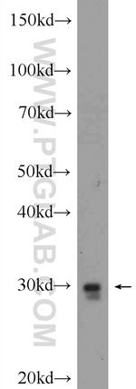 TOLLIP Antibody in Western Blot (WB)