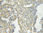 OSBPL11 Antibody in Immunohistochemistry (Paraffin) (IHC (P))