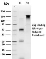 ECD/SGT1 Antibody in Immunoelectrophoresis (IE)