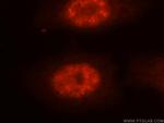 NASP Antibody in Immunocytochemistry (ICC/IF)