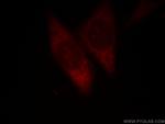 DDX20 Antibody in Immunocytochemistry (ICC/IF)