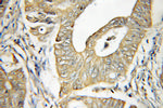 DDX20 Antibody in Immunohistochemistry (Paraffin) (IHC (P))