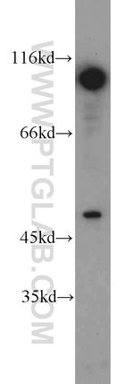 DDX20 Antibody in Western Blot (WB)