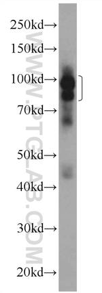 DDX20 Antibody in Western Blot (WB)