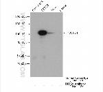 DDX20 Antibody in Immunoprecipitation (IP)