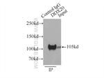 DDX20 Antibody in Immunoprecipitation (IP)