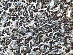 LAT Antibody in Immunohistochemistry (Paraffin) (IHC (P))