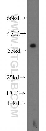 LAT Antibody in Western Blot (WB)