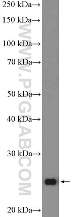 LAT Antibody in Western Blot (WB)