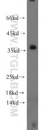 LAT Antibody in Western Blot (WB)