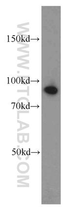 ATRIP Antibody in Western Blot (WB)