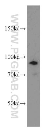 ATRIP Antibody in Western Blot (WB)