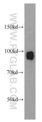 ATRIP Antibody in Western Blot (WB)