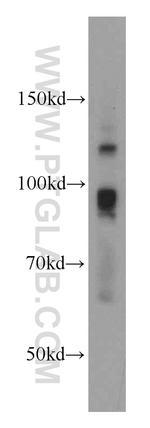 ATRIP Antibody in Western Blot (WB)