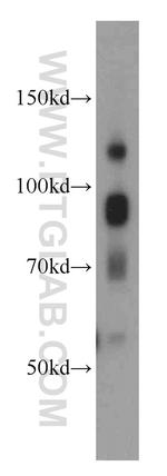 ATRIP Antibody in Western Blot (WB)