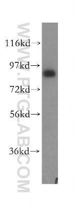 Integrin beta-7 Antibody in Western Blot (WB)